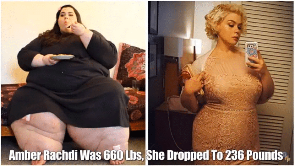 Side by side image of same woman after she lost 236 pounds after using Dr. Nowzaradan's 1,200 Calorie Diet